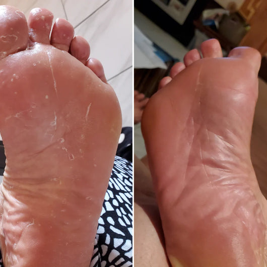 RashBreak Formula Men