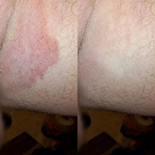 RashBreak Formula Men