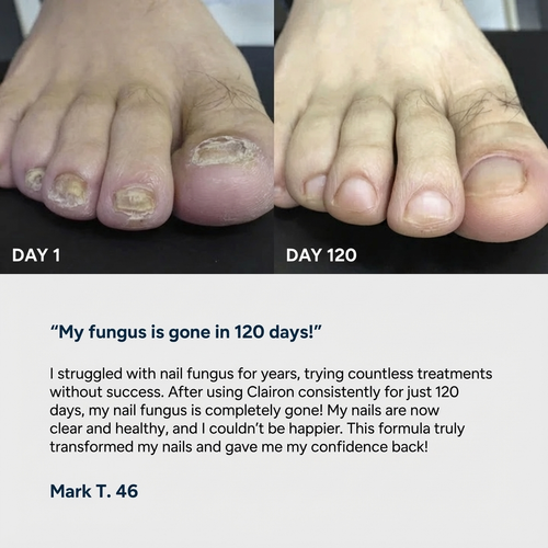 Nail Fungus Complete Care Gel