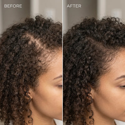 Growturn Hair Growth Serum