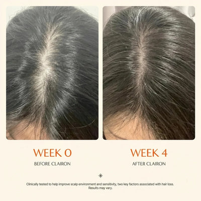 Growturn Hair Growth Serum