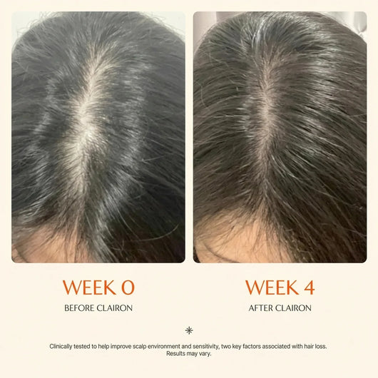 Growturn Hair Growth Serum